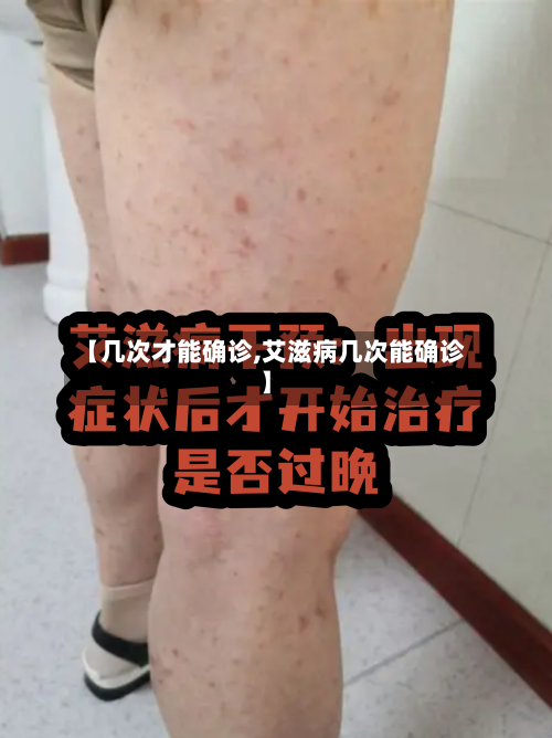 【几次才能确诊,艾滋病几次能确诊】