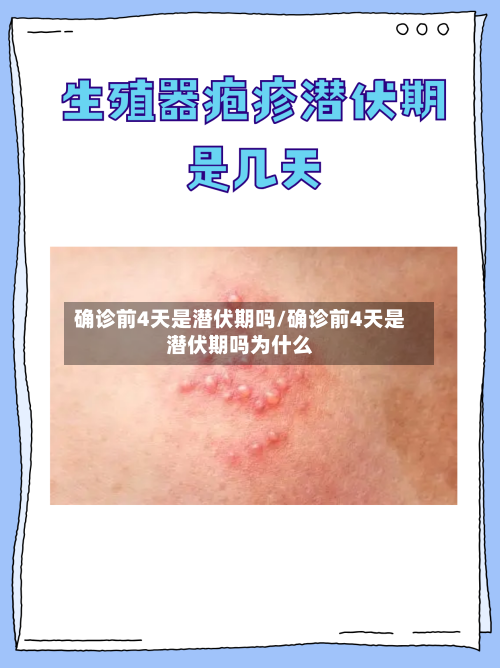 确诊前4天是潜伏期吗/确诊前4天是潜伏期吗为什么