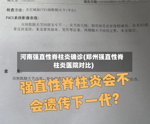 河南强直性脊柱炎确诊(郑州强直性脊柱炎医院对比)