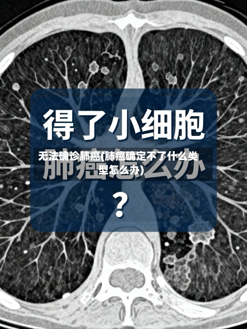 无法确诊肺癌(肺癌确定不了什么类型怎么办)