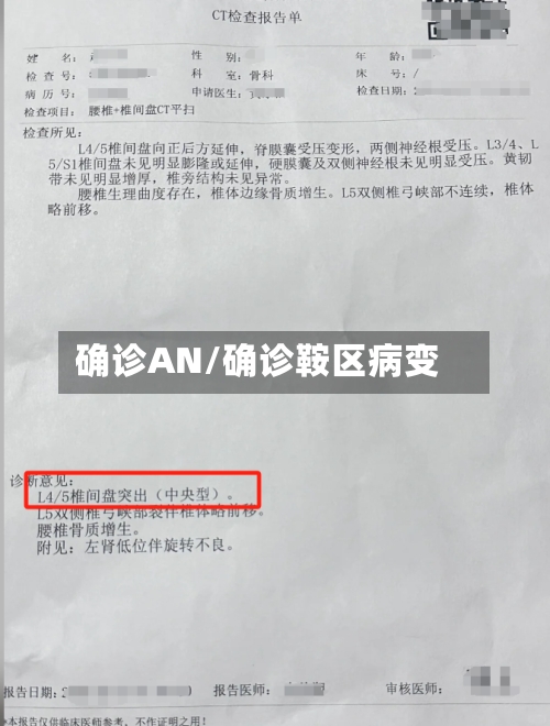 确诊AN/确诊鞍区病变